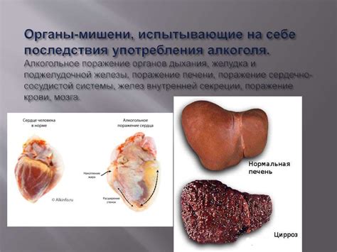 Алкогольное поражение органов