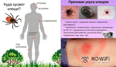 Аллергические реакции на укус клеща