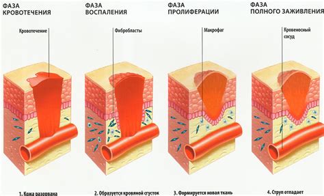 Альтернативные методы для быстрого заживления ран