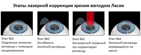 Альтернативные способы коррекции зрения для снижения нагрузки на глаза