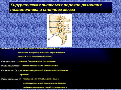 Важные факторы, определяющие необходимость операции на позвоночнике