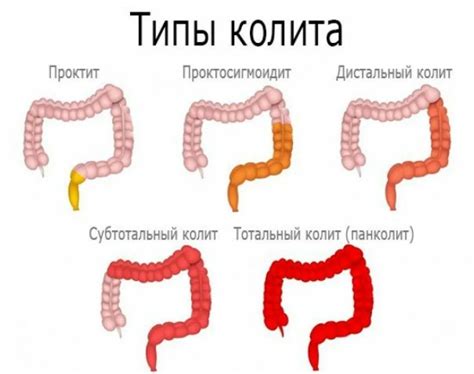 Важные факты о заболевании