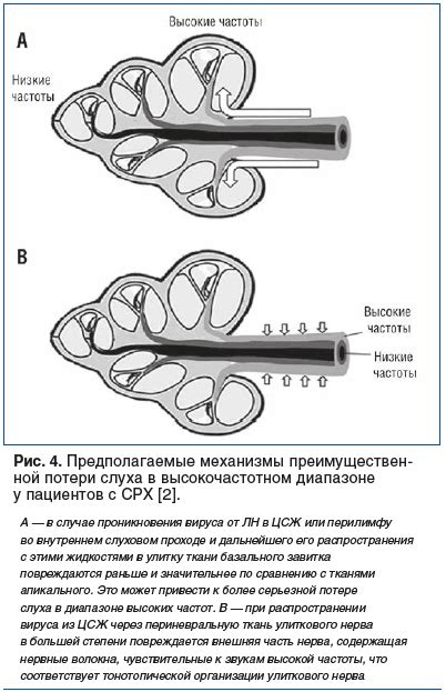 Вестибулярные нарушения и связь с головокружением