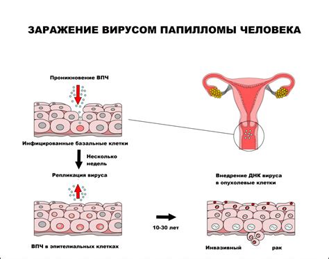 Вирус папилломы человека: мифы и факты о его передаче от мужчины