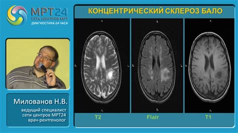 Влияние головного удара в ЮФС: правила и последствия