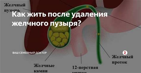 Влияние желчного пузыря на процесс похудения