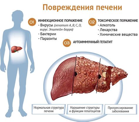 Влияние застоя желчи на функцию печени