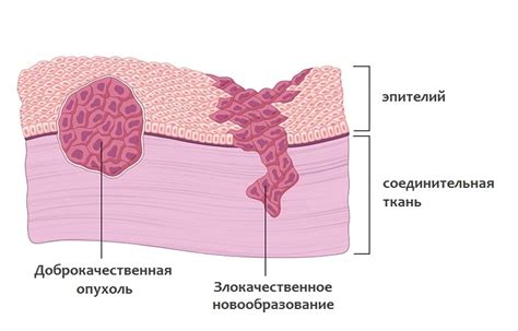 Влияние интервалов между мутациями на рост опухоли