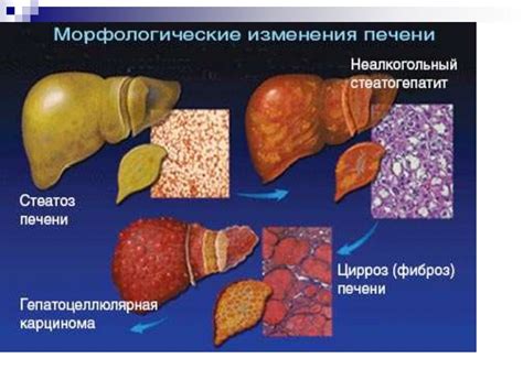 Влияние йодомарина на работу пищеварительной системы