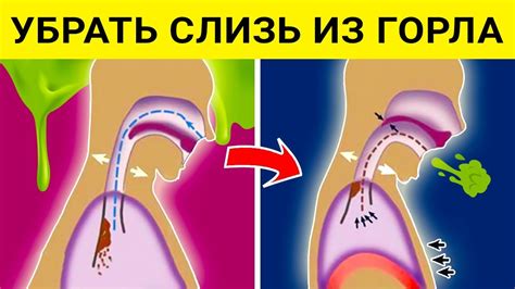 Влияние слизи и мокроты на организм: причины и последствия