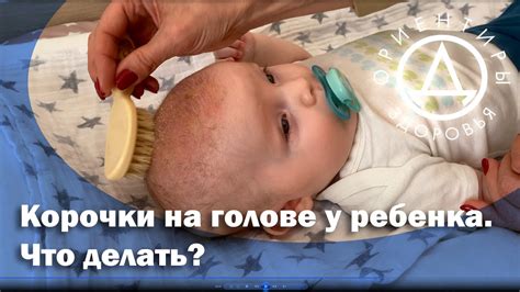 Внимательно осмотрите щетину на голове ребенка