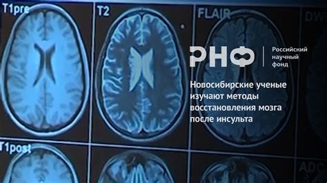 Возможность восстановления мозга после приема нейролептиков