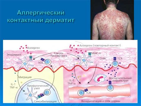 Возможность отслеживать аллергические реакции