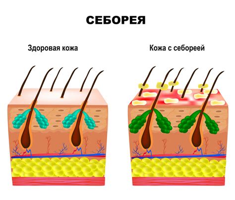 Возможность переноса вшей и их воздействие на волосы