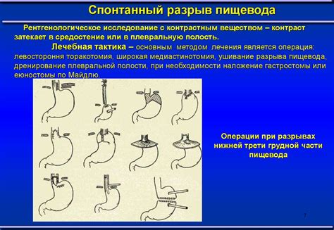 Возможность повреждения пищевода