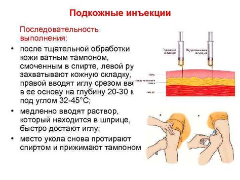 Возможные осложнения после капельницы: