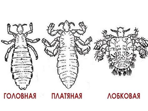 Возможные пути передачи вшей