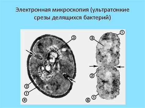 Возникновение микроскопии