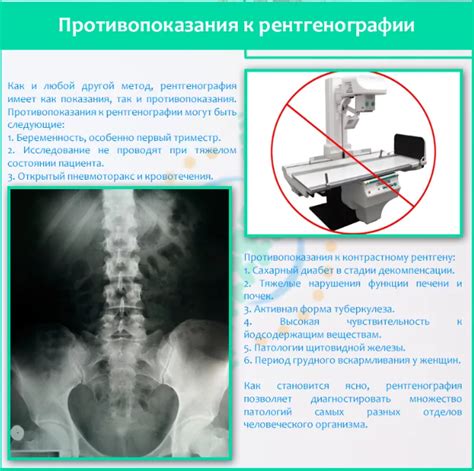 Вредит ли пища перед рентгеном позвоночника?