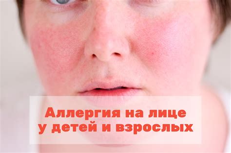 Вредные последствия употребления сухарей при аллергии