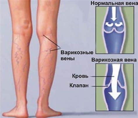 Вреды мытья во время болезни: на самом ли деле?