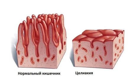 Вред глютена в макаронах из твердых сортов пшеницы