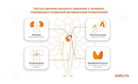 Вред или польза - влияние спорта на давление?