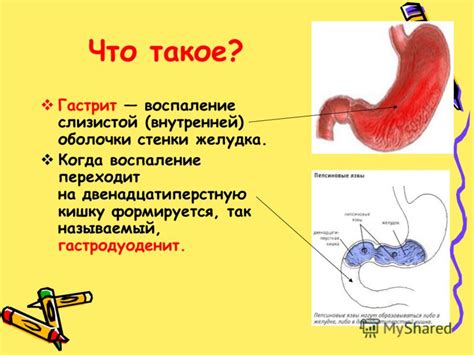 Гастродуоденит и кукуруза: взаимосвязь