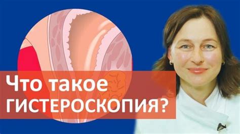 Гистероскопия: подготовка к исследованию