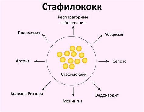 Главные причины заражения стафилококком