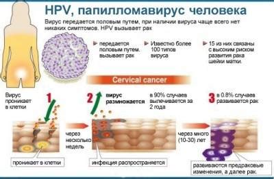 Главные пути передачи ВПЧ