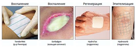 Гнойная рана: что это и как она возникает?