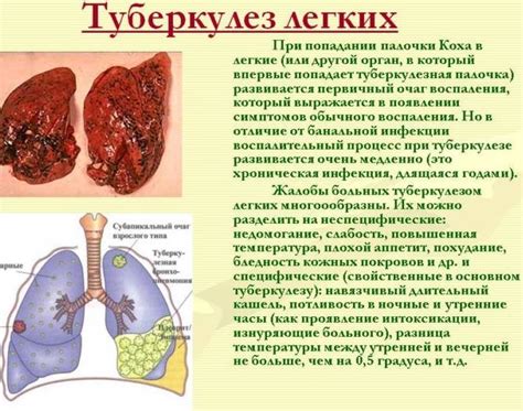 Грибковая пневмония и ее последствия для центральной нервной системы