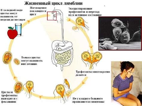 Диагностика и лечение лямблиоза