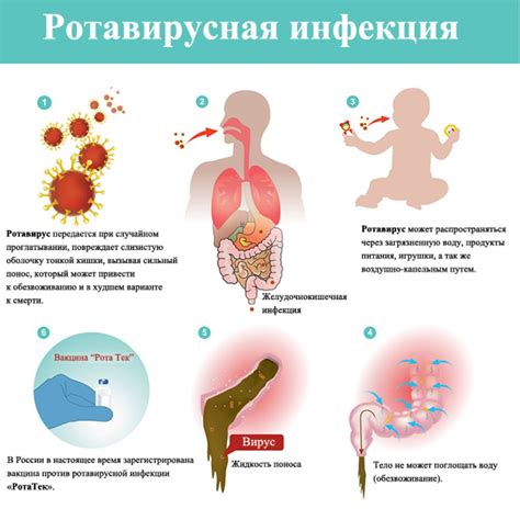 Диагностика ротовирусной инфекции