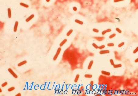 Диагностика clostridium perfringens