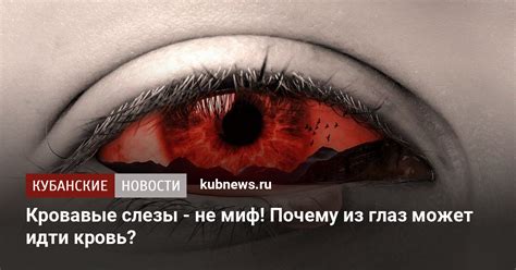 Домашние способы снять кровь из глаза