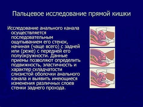 Дополнительные методы исследования при сомнительных результатах пальпации опухоли в прямой кишке