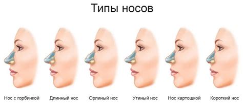 Естественные изменения формы носа в процессе старения