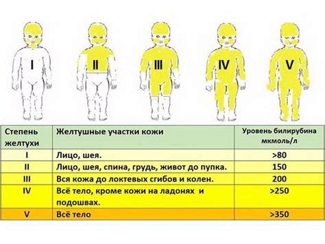 Желтушка: симптомы и причины