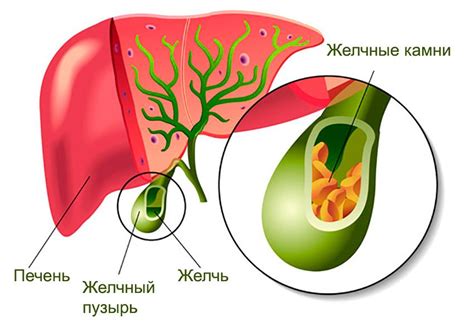 Желчный пузырь: его функции и удаление