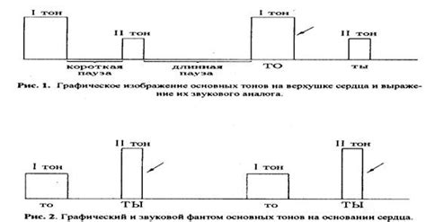 Загевание основных тонов