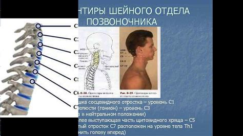 Запомните симптомы простуды шеи: