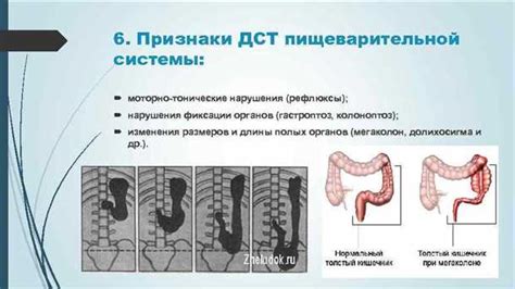 Затруднение пищеварения