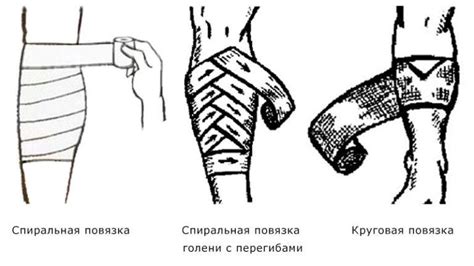 Зачем использовать бинты после операции на ночь?