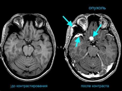 Зачем нужна КТ со средством контраста?