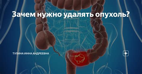 Зачем нужно удалять воск с посуды