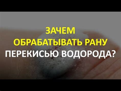 Зачем обрабатывать прыщи перекисью водорода?