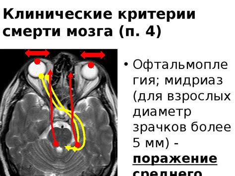 Индикаторы смерти мозга