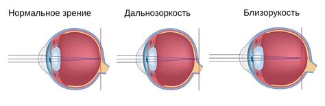 Инфраструктура и аккомодация